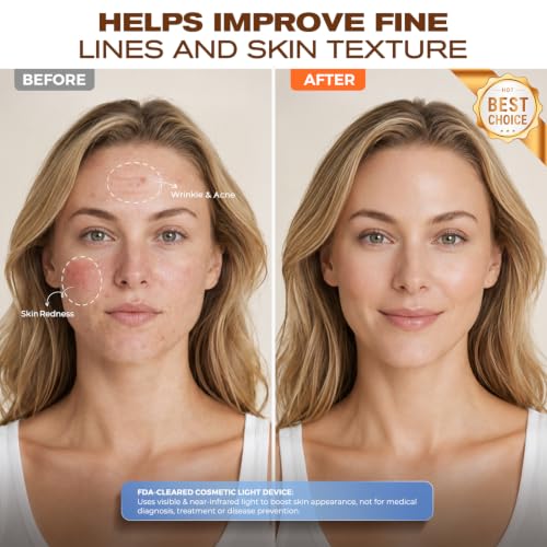 Image of Avvnee FDA-Cleared Red Light Therapy Mask for Face, 850nm NIR | Anti Wrinkles & Acne, Fine Lines, 4 Modes: Infrared /Red /Blue /Amber, 30mW /cm, 240 LEDs, 10 Min, Glowing Skin for Home Use