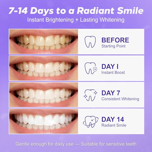 Image of Purple Teeth Whitening Strips 28 Count - 14 Days Treatment Whitener Strips with Non Slip & Enamel Safe & Non Sensitive, Teeth Whitening Kit for Coffee, Wine Stains Removal Fastly (28 Strips - Purple)