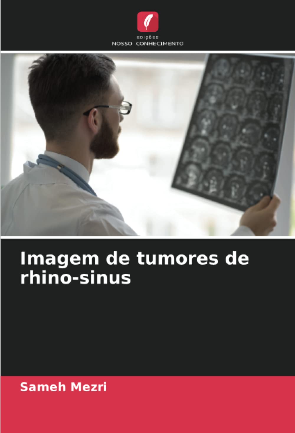 Imagem de tumores de rhino-sinus