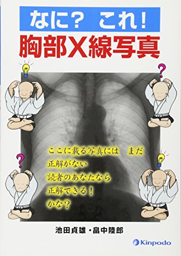無料電子書籍 pdf なに?これ!胸部X線写真 バイ