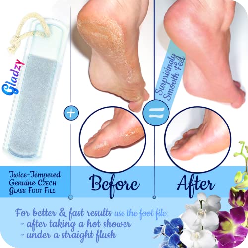 Gladzy GL-AIOS-CLEAR Genuine Czech Glass Nail File Set By Gladzy - Callus Remover Foot Rasp thumb #6