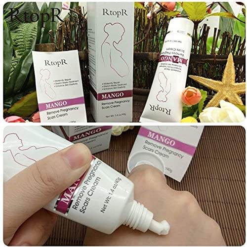 RtopR Mango Stretch Marks and Scar Cream - Stretch Marks and Scar Removal Cream for Gravidez - Melho