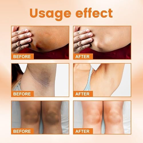 Skin Whitening Cream Lightening Serum for Intimate Areas and Bikini Area, Vitamin C Dark Spot Remover Corrector for Neck, Armpit, Underarm, Elbow, Inner Thigh and Knees (1.8 FL.Oz)