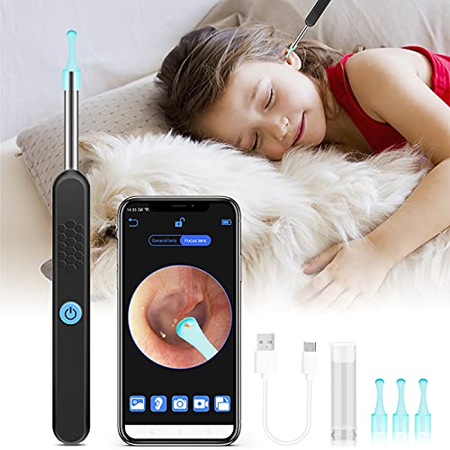 Ear Wax Removal Tool Camera, Ear Cleaning kit Smart Visual Ear Cleaner,1296P Wireless Ear Otoscope, Ear Scope with Ear Wax Cleaner Tool for Babies Kids Adults Pets