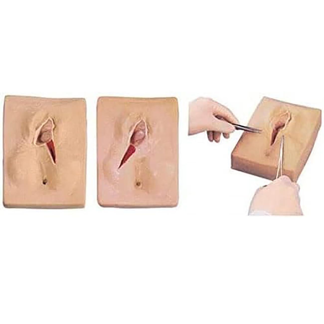 Medarchitect Modello di pratica della sutura perineale dell'incisione della vulva femminile (linea mediana) Lacerazione/Episiotomia Simulatore di sutura Pratica per l'insegnamento di ginecologia a