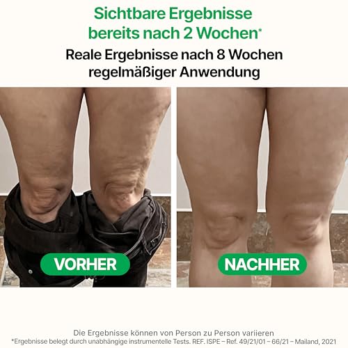 TESMED-CELLULITE-Manuelles-Anti-Cellulite-Massagegeraet-Made-in-Italy-Patentiert-Getestete-Wirksamkeit-Massage-Roller-fuer-Oberschenkel-Gesaess-Hautstraffung - Sparfuchs24.io - Preisvergleich & Top Angebote Online