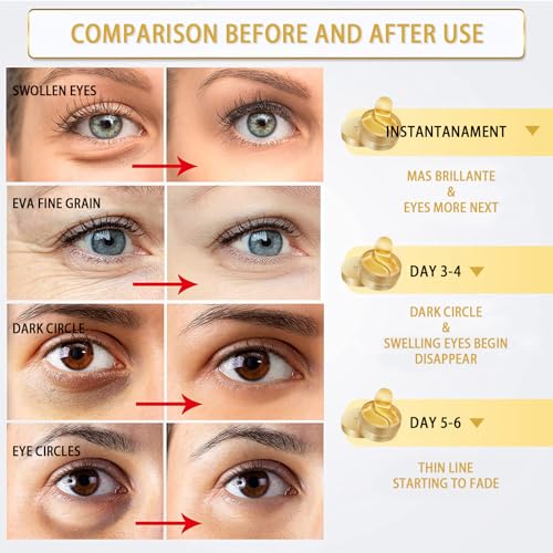 Under Eye Patches, Gold Eye Masks for Puffy Eyes, Under Eye Masks, Dark Circles Under Eye Treatment Women, Improve Under Eye Bags, Fine Lines and Wrinkles, Eye Masks Skincare, 30Pairs - Image 4