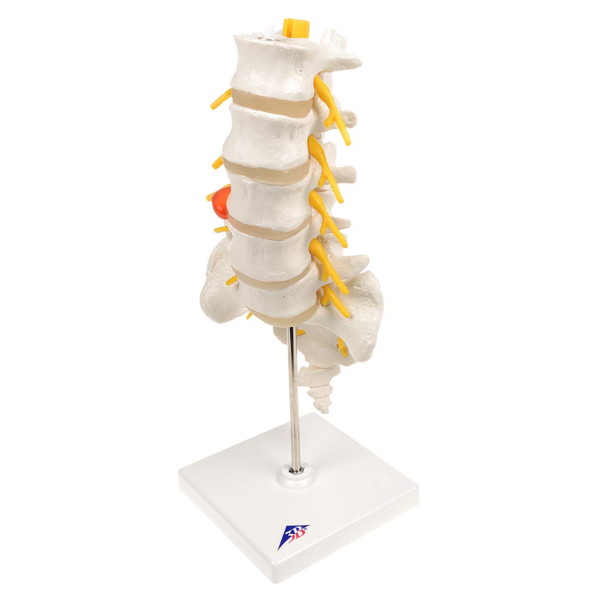 3B Scientific A76/5 Colonna Vertebrale Lombare con Ernia del Disco Dorsolaterale + software gratuito di anatomia - 3B Smart Anatomy
