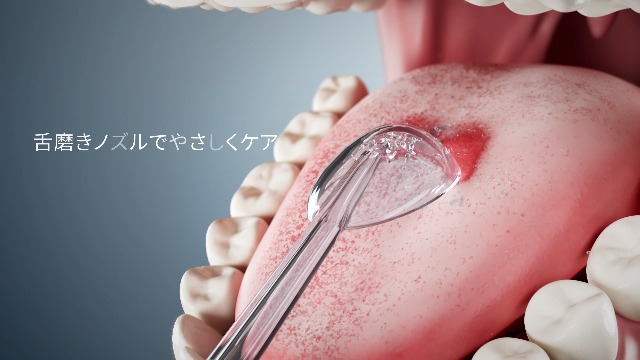 Amazon.co.jp: 口腔洗浄器 ジェットウォッシャー Aolmfek 業界初 浄化