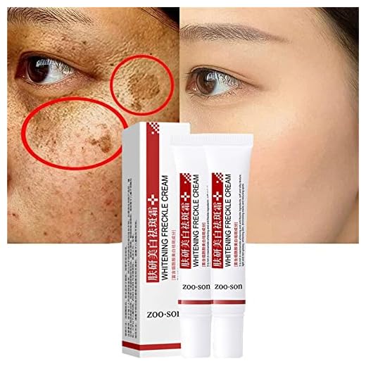 Spot off Freckle Whitening Cream, Dark Spot Corrector Cream, Acne Scar Removal Cream, Effective Moisturizing Acne Spot Treatment Cream, Melasma Melanin Pigmentation Removal Cream for Face (2 Pcs)