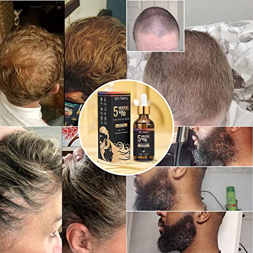 5% Minoxidil For Men And Women, Biotin Hair Growth Serum, Hair Regrowth Treatment 60Ml For Thicker Longer Healthier Hair, Prevent Scalp Hair Loss Thinning, Natural Fuller Healthier Hair(1 Pack) #TOP6