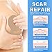 Silicone Scar Sheets - Reusable Breast Scar Tapes - 4 Pair Medical Grade Silicone Strips, Soft & Breathable for Post-Surgical Scar Prevention & Treatment