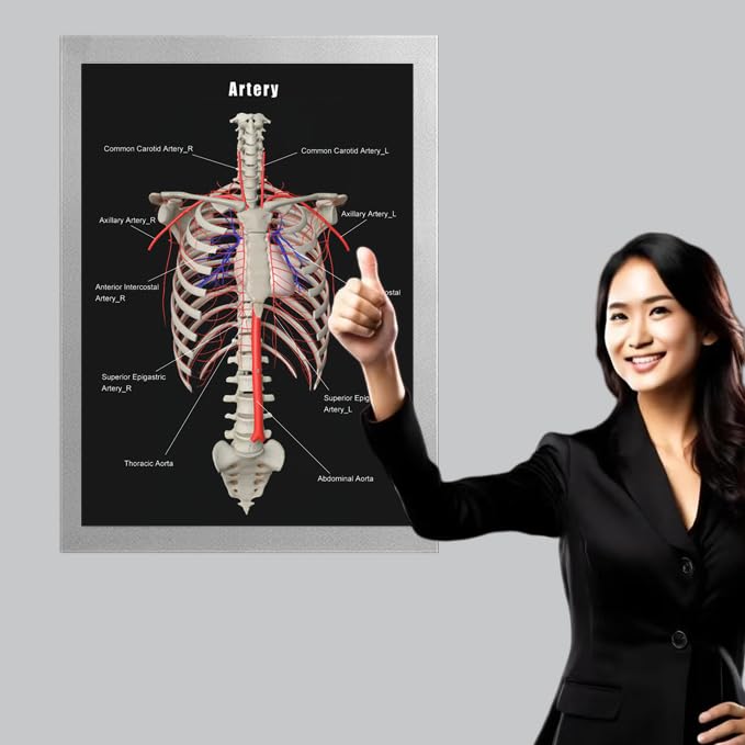 Image of Taanfu Body Educational Learning Anatomy Posters ，Arterial skeleton Art Arterial Villi Anatomy Art Poster Digestive System Organs Illustration Small Intestine Physiology Anatomy Wall Art Villi