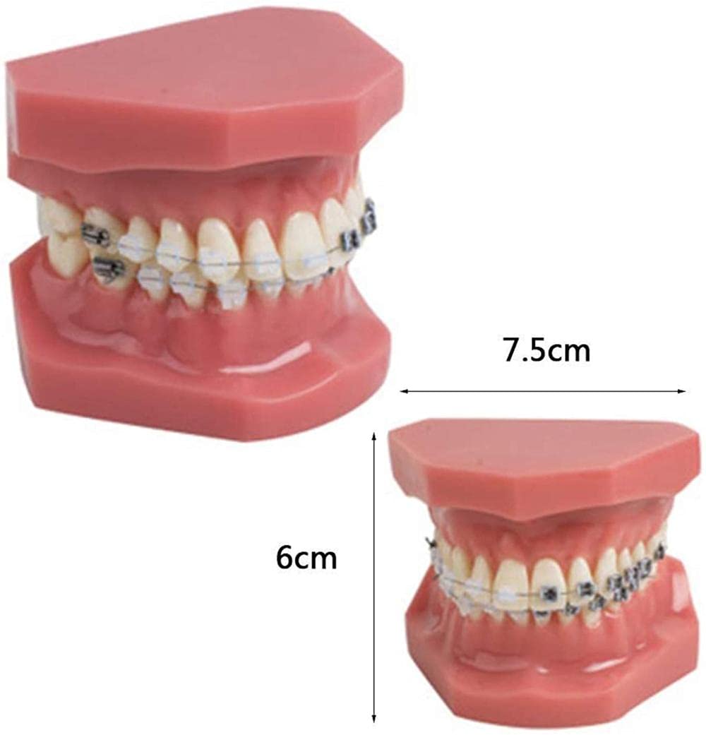 NaoSIn-Ni Model do nauki model zębów dentystyczne malokluzja ortodontyczne leczenie l nauka zębów do nauki 1 szt. medyczne narzędzie do nauki zabawka