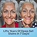 MySweetSmile Pap Teeth Whitening Strips - Enamel-Safe, Sensitivity-Free Formula - 42 Peroxide-Free Whitening Strips - Dentist-Approved - IndyBest Award-Winning Brand - 21 Treatments - Mint Flavour