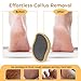 OUKEYA Glass Foot File Callus Remover - Nano-Glass Pedi Egg Pumice Stone for Feet Dead Skin, Plastic-Free Pedicure Foot File Callus Remover
