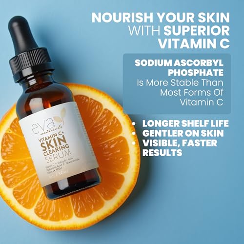 Image of Vitamin C Serum for Face with Retinol & Salicylic Acid - Skin Clearing Acne Spot Treatment with Niacinamide, Hyaluronic Acid, MSM - Anti-Aging Facial Serum for Dark Spots and Blemishes