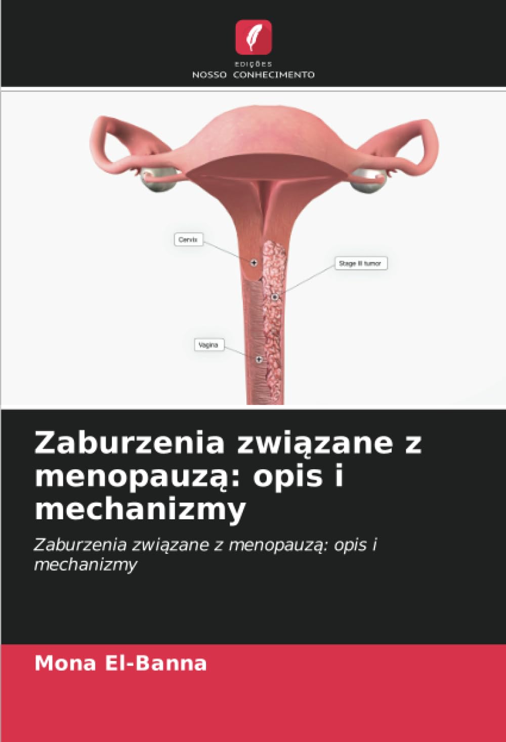 Zaburzenia związane z menopauzą: opis i mechanizmy