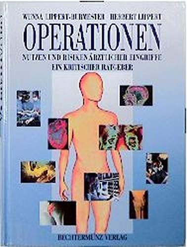 Operationen: Nutzen und Risiken ärtzlicher Eingriffe - Ein kritischer ratgeber