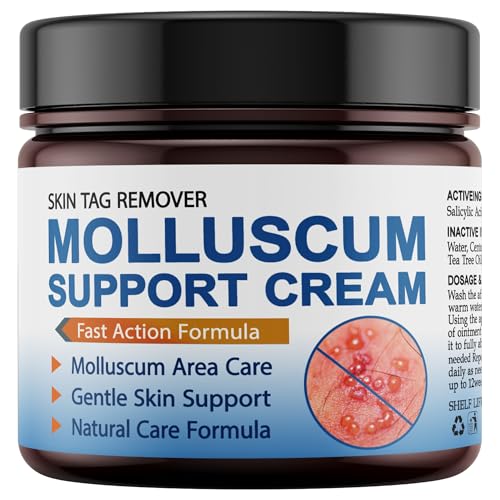 NateNatenight Molluscum Support Treatment, Molluscum Support Cream All Natural Support Cream for Molluscum Rash, 30g