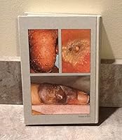 Color atlas of infectious diseases (Year Book color atlas series) 0815131186 Book Cover