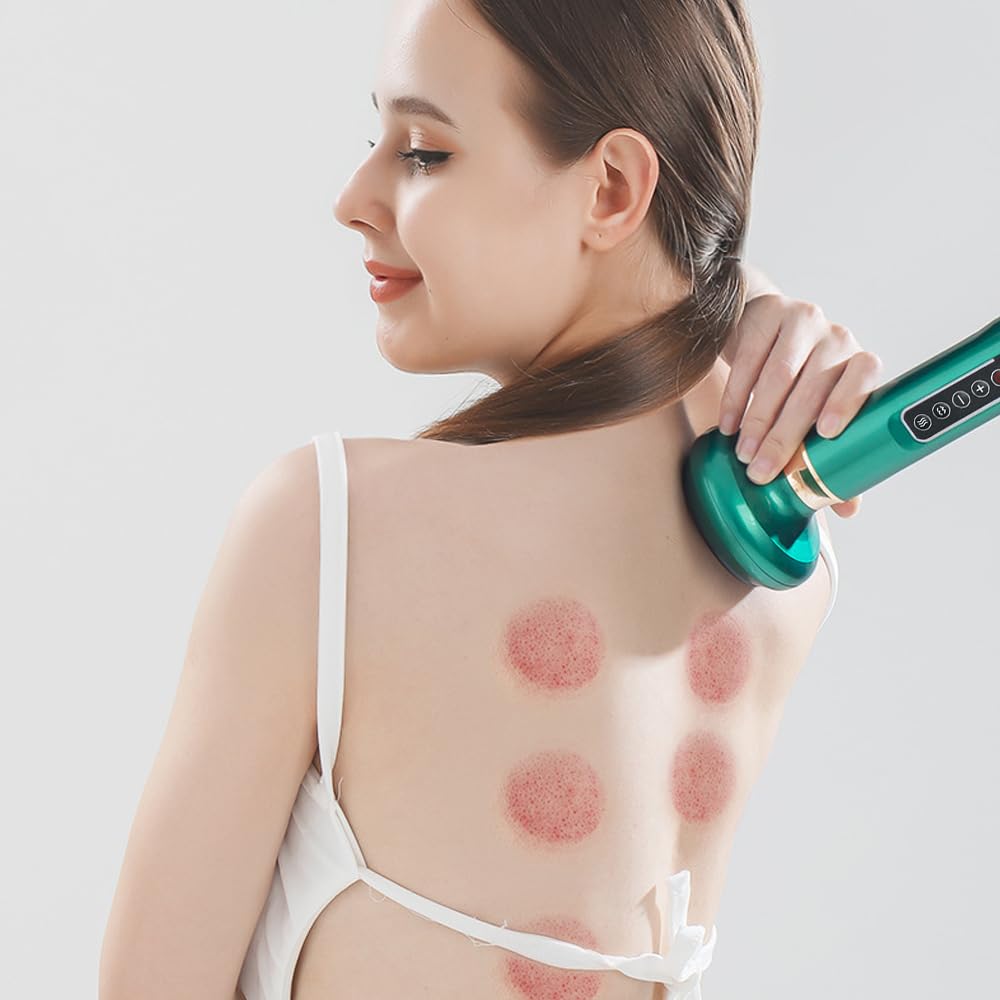 Cellulite-Massagegerät, Schröpfgerät zur Reinigung der Meridiane, Cellulite-Gerät, Verstellbarer Body Shaper für den Bauch, Varially Anti Cellulite Massager