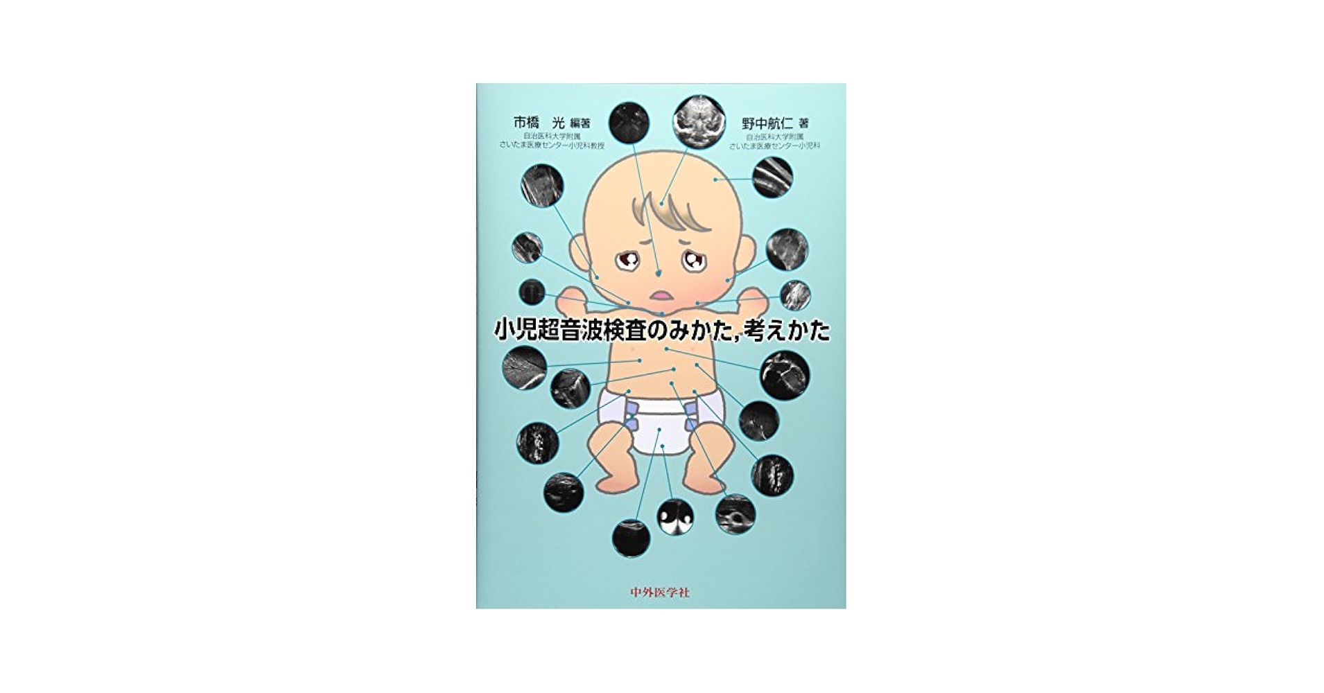Amazon.co.jp: 小児超音波検査のみかた,考えかた : 市橋光, 野