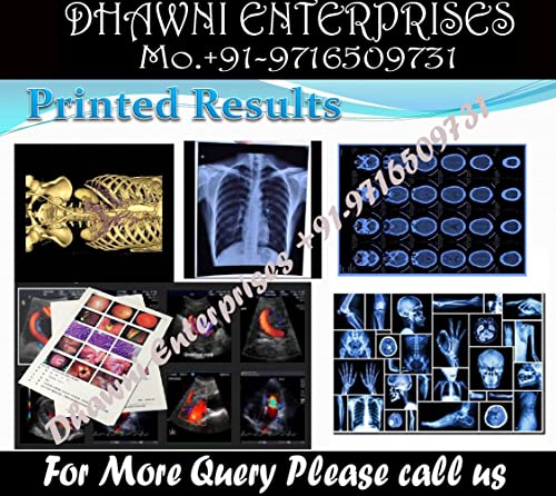 Image of Dhawni Xray Blue Inkjet Medical Film for X Ray imaging waterproof Film (8 inch X 10 inch) 100 Sheet 280 GSM / 210 Micron
