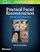 Practical Facial Reconstruction