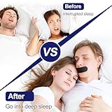 Zoom IMG-2 100 pezzi anti russare mouth Zoom IMG-2 100 pezzi anti russare mouth