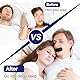 Forhome 100 Stück Mundpflaster Gegen Schnarchen,Mouth Tape for Sleeping,Mundkleber Schnarchstopper Nachts Mundpflaster, für Männer und Frauen geeignet,Mund Tape Schlaf für Besser Schlafen und Atm