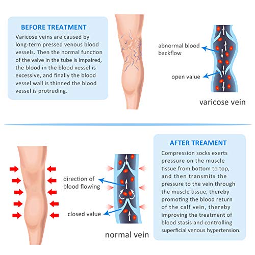 YISEMEYA Calze a compressione medica da 20 a 30
