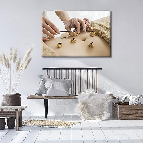 Image of Posters & Prints 1 Panels Nosocomium Paintings Wall Art Moxibustion Art Prints Framed Wall Art Nosocomium Giclee Wooden Framed Gallery-Wrapped Ready to Hang (16 inch Wx24 H)