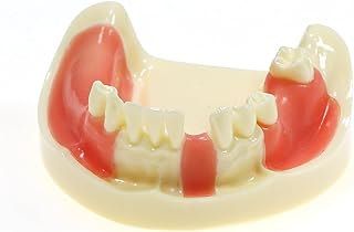 Dental Implant Practice Typodont Lower Jaw Teeth Model Removable Gingiva M2004