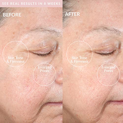 PMD Beauty Sauber Pro RQ Gesichtsbehandlung Reinigend Gerät, Erröten, 320 g