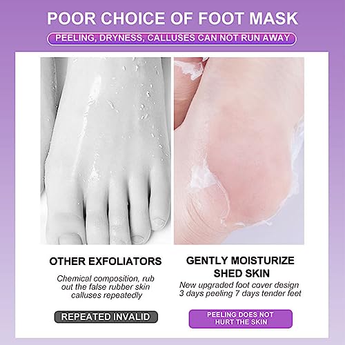 Joyeee Mascarilla Exfoliante Pies, Calcetines Exfoliantes de Pies para Callos Pies y Peeling Pies, Foot Peel Mask para Mujeres y Hombres, Lavanda, 5 Pares - imagen 5