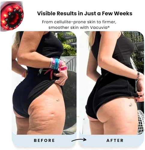 Vignette produit