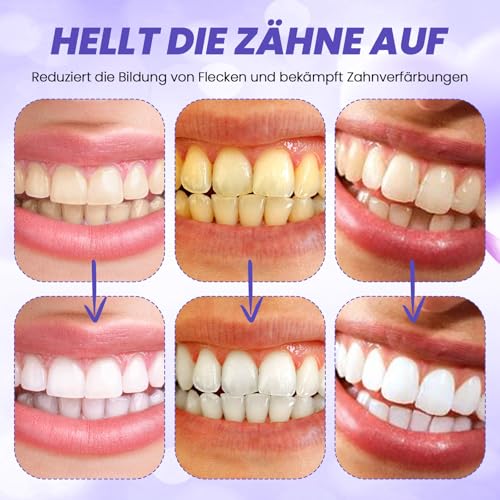 KAIOWPEIC Lila Zahnpasta Whitening, Zahnbleichende Zahnpasta,Strahlend Weiße Zähne,Zahnfleisch Reparatur,Effektive Verfärbungsentfernung, Zahnschmelzschutz, Frischer Atem