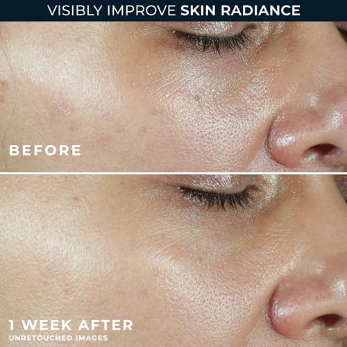 RoC Multi Correxion Vitamin C Sunscreen Broad Spectrum SPF 30 Moisturizer | 2-in-1 Lightweight Moisturizer and Sun Protection to Help Prevent Signs of Aging - image 5