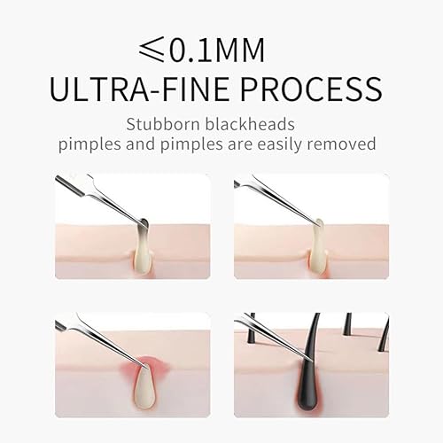 Miniatura 4 de Pinzas profesionales para eliminar puntos negros, 3 unidades, pinzas para eliminar puntos negros, extractor de precisión, kit de eliminación de