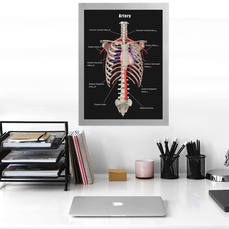Image of Taanfu Body Educational Learning Anatomy Posters ，Arterial skeleton Art Arterial Villi Anatomy Art Poster Digestive System Organs Illustration Small Intestine Physiology Anatomy Wall Art Villi