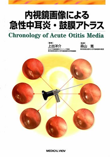 楽天 無料電子書籍 内視鏡画像による急性中耳炎・鼓膜アトラス バイ