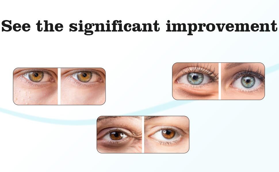 Minty Chill Steam Eye Mask, Self Heating, Warm Compress, Disposable - Image 3