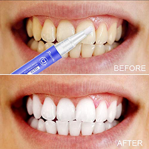 Teeth Whitening Pen -Teeth Whitener For Removes Years of Stains Caused by Coffee, Wine, Smoking, Travel-Friendly(2 Pack/0.34FL.OZ)