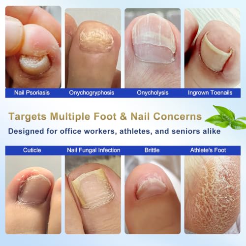Image of Toenail Fungi Treatment Extra Strength - Fungi Nail Pen