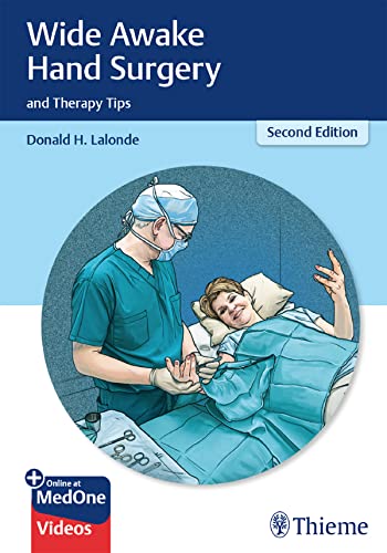 Wide Awake Hand Surgery and Therapy Tips (English Edition)
