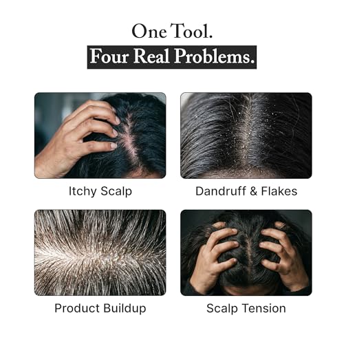 Image of Nimzo Silicone Scalp Massager Shampoo Brush | Hair Massager for Hair Growth, Dandruff Removal, Blood Circulation | Exfoliate (Black & White)