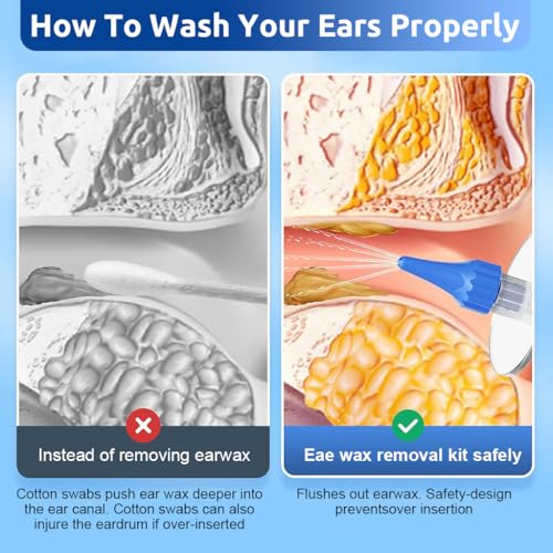 Image of HANNEA Manual Ear Canal Irrigator Kit with 250ml Water Cup, 11 Nozzles (10 Single-Hole + 1 Five Hole) Gentle Ear Wax Remover Tool Set for Kids & Adults, Safe Ear Cleaning Rinser