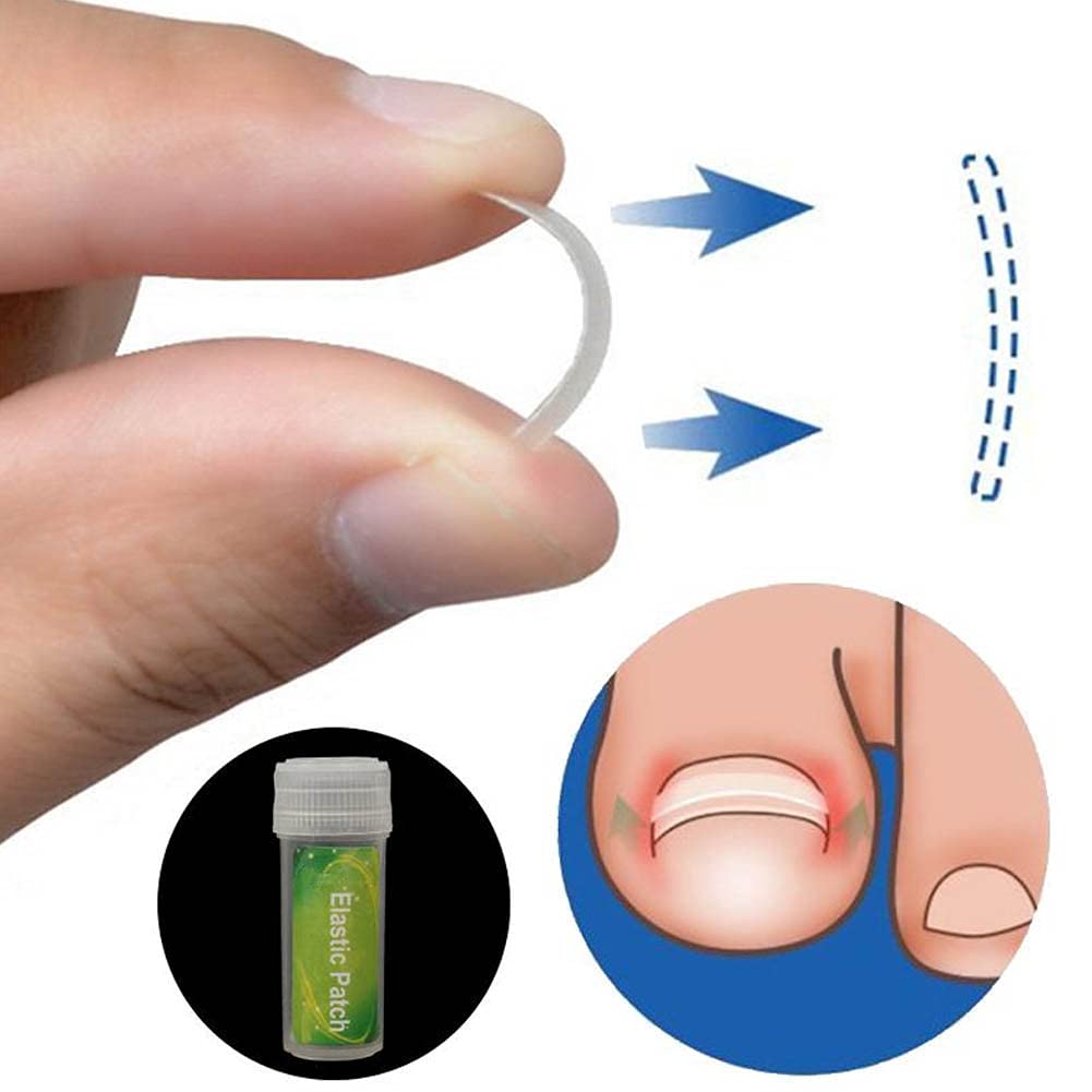Ingrown Toenail Corrector 6 in 1 set Ingrown Toe Nail Fixer Toenail Removal Kit Toenail Straightener Pedicure Toenail Recover Correction Tool Ingrown Nail Softener Nail Foot Care Kit(24pcs) : Beauty & Personal Care