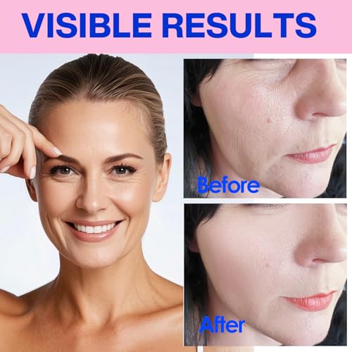 zancony Face Tape for Wrinkles Overnight Flexible Full Facial Face winkle Tape Smooth Fine Lines Anti Wrinkles Patches For Forehead | Smile Lines | Neck | Double Chin | Instant face lift 2.5CM*5M 125pcs